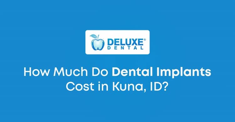 How Much Do Dental Implants Cost in Kuna, ID?