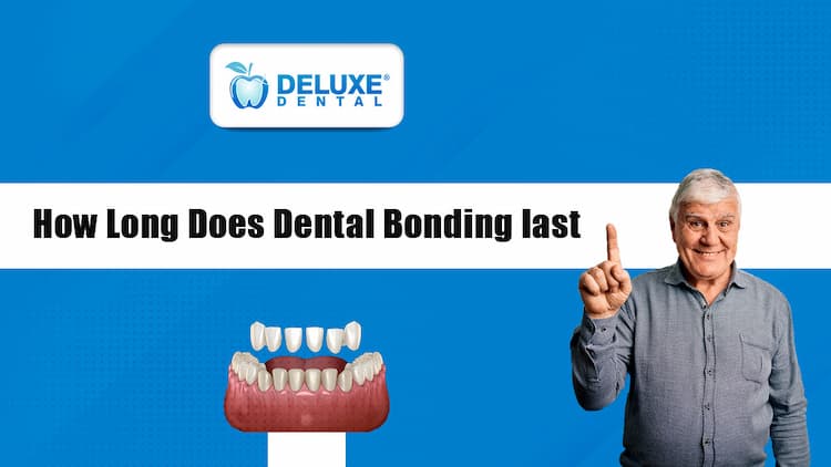 How long does dental bonding last?