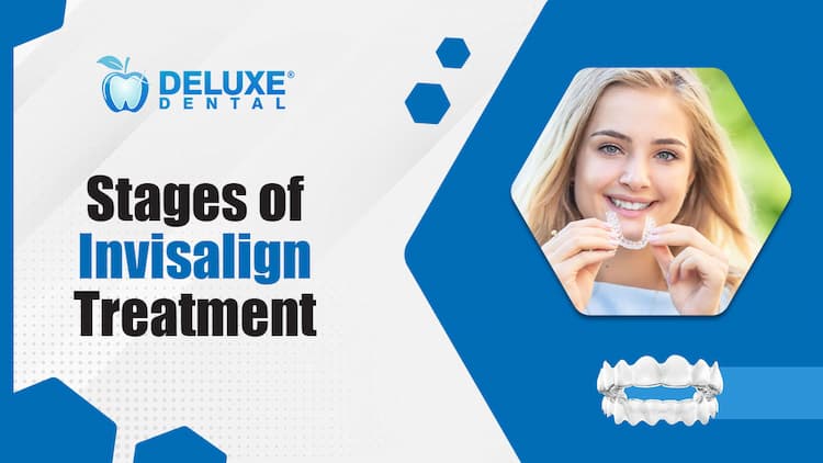 Stages Of Invisalign Treatment